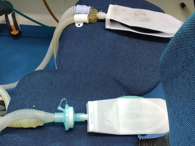 Técnica validada permite que até quatro pacientes sejam conectados ao mesmo respirador Técnica validada permite que até quatro pacientes sejam conectados ao mesmo respirador